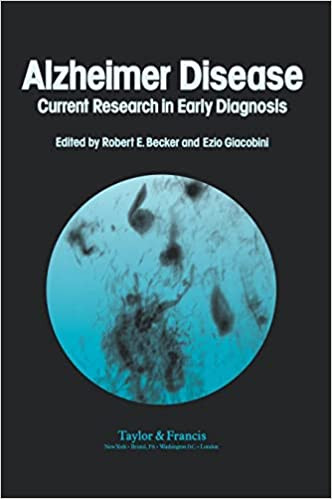 Alzheimer's Disease: Current Research In Early Diagnosis Hardcover – Illustrated, 19 September 1990